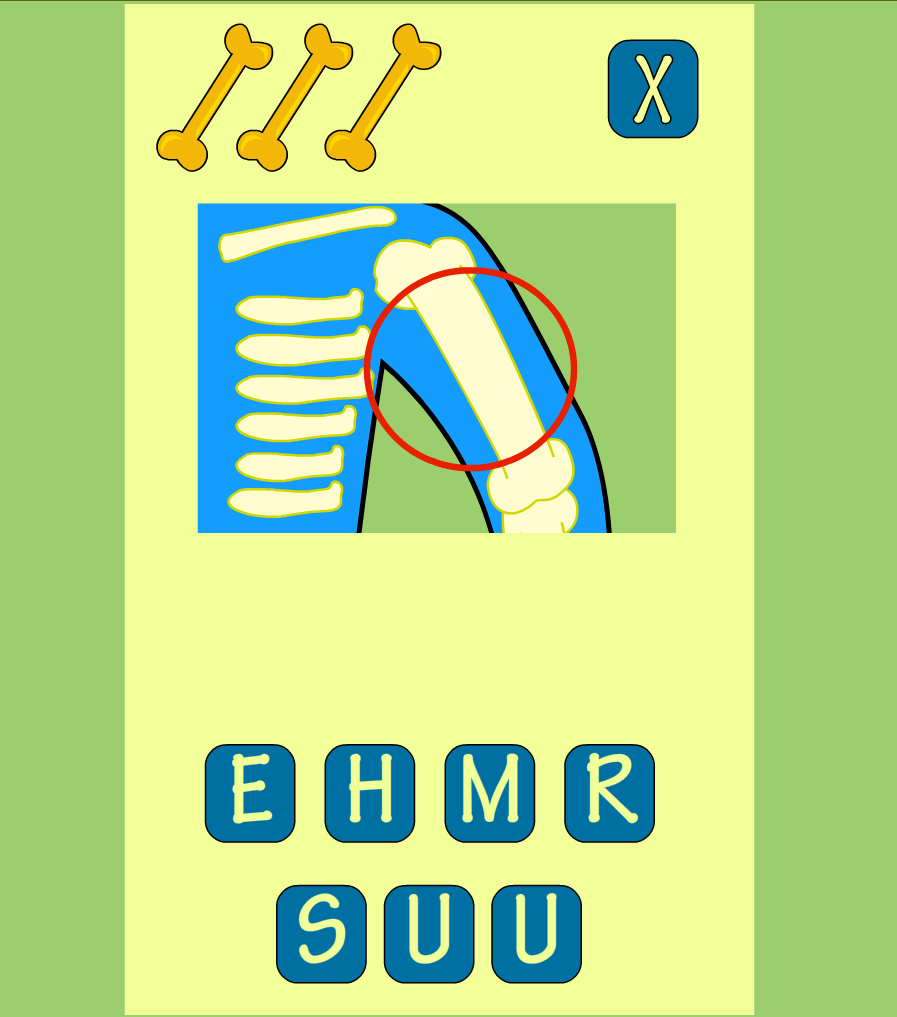 An image of an arm bone with a bunch of randomised letter tiles below it.